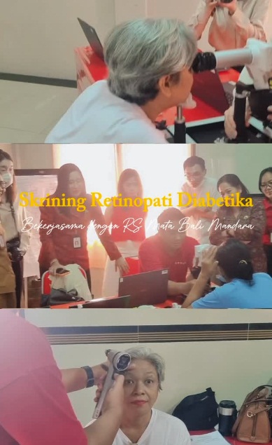 Kegiatan Skrining Retinopati Diabetika bekerjasama dengan RS Mata Bali Mandara